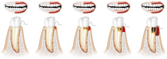 Parodontologia Torino